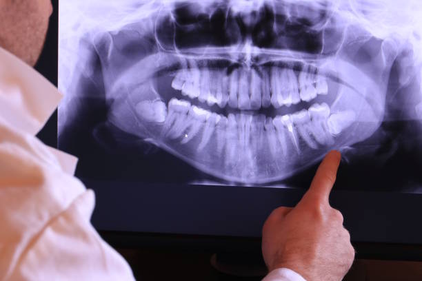 Best Chipped Tooth Repair Near Me  in Brentwood, PA